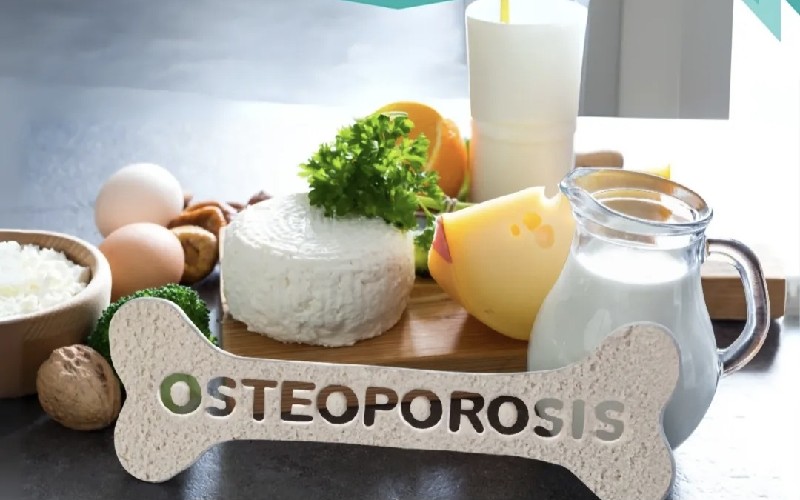 RSUD Subang Ajak Masyarakat Peduli Kesehatan Tulang, Cegah Osteoporosis Sejak Dini